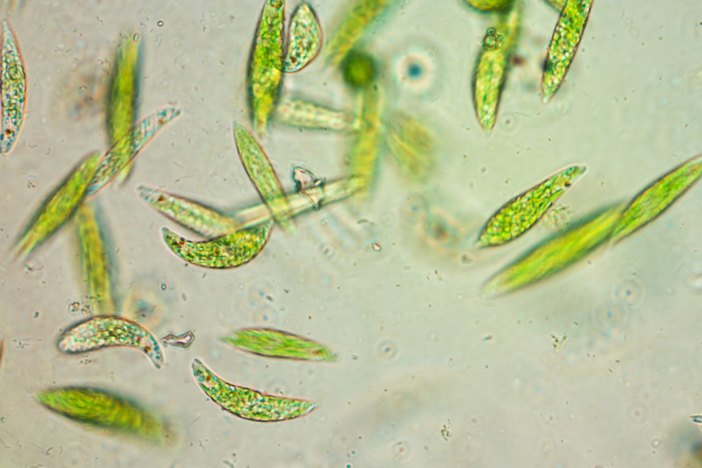 Primarily microscopic single-celled organisms that have complex internal structures.  Most are found in water and include amoeba and algae.