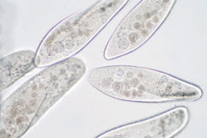 Protists that use tiny hair-like cilia to move through the water, eating smaller protists.