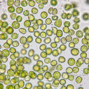 400x Single-celled photosynthetic protists that live in water.  The fungus provides a moist, nutrient-rich environment.