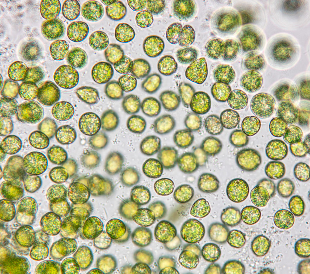400x Single-celled photosynthetic protists that live in water.  The fungus provides a moist, nutrient-rich environment.