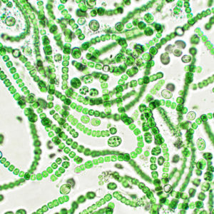 600x
Single-celled even thought they look like a string of pearls.  These are photosynthetic bacteria that are  also typically found in water,