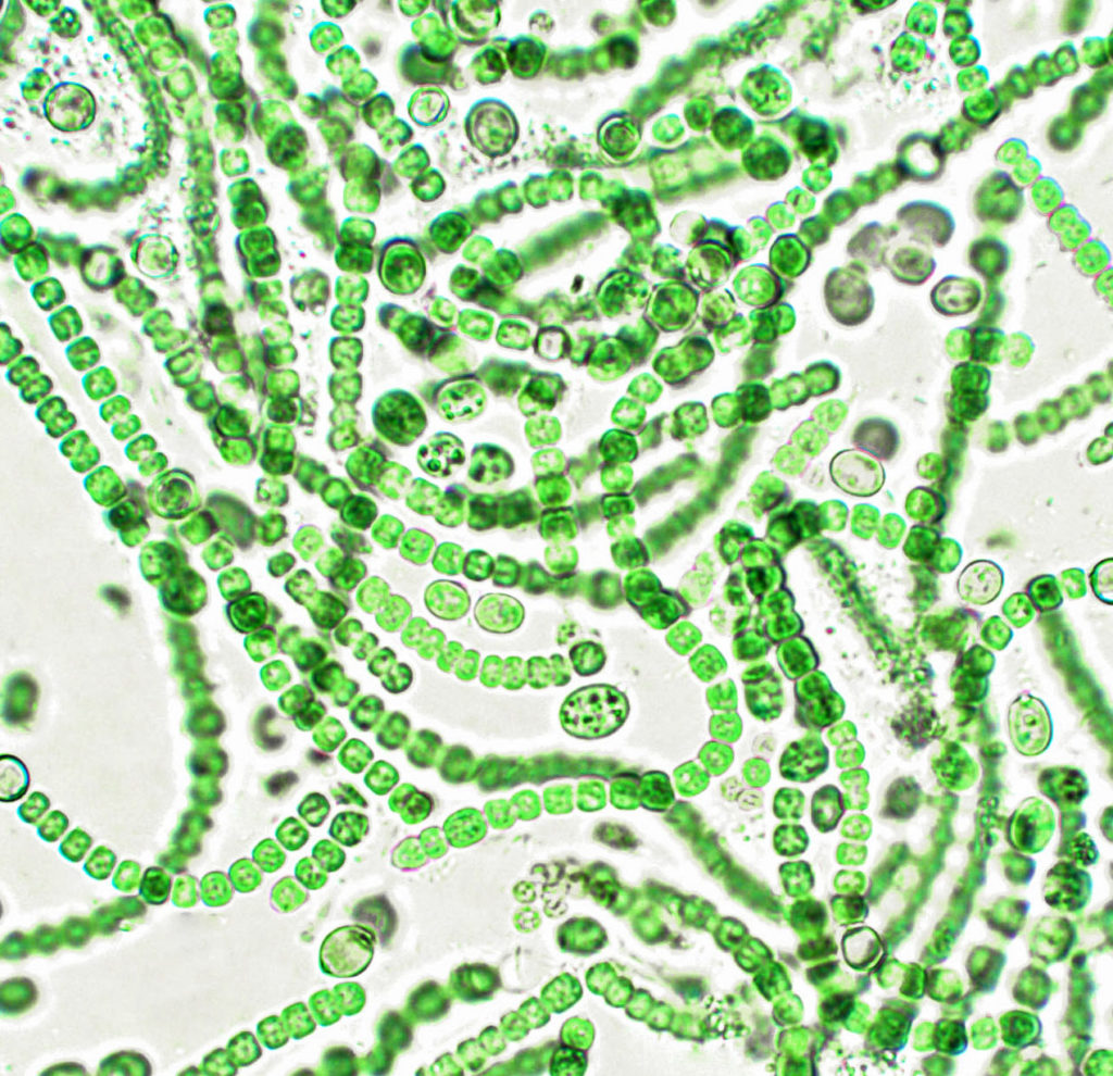 600x
Single-celled even thought they look like a string of pearls.  These are photosynthetic bacteria that are  also typically found in water,
